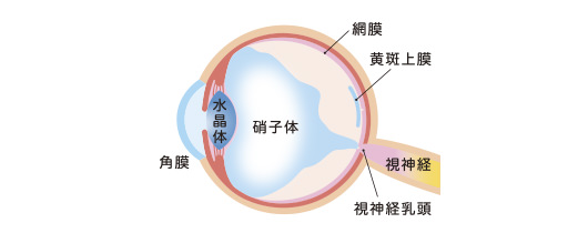 硝子体手術