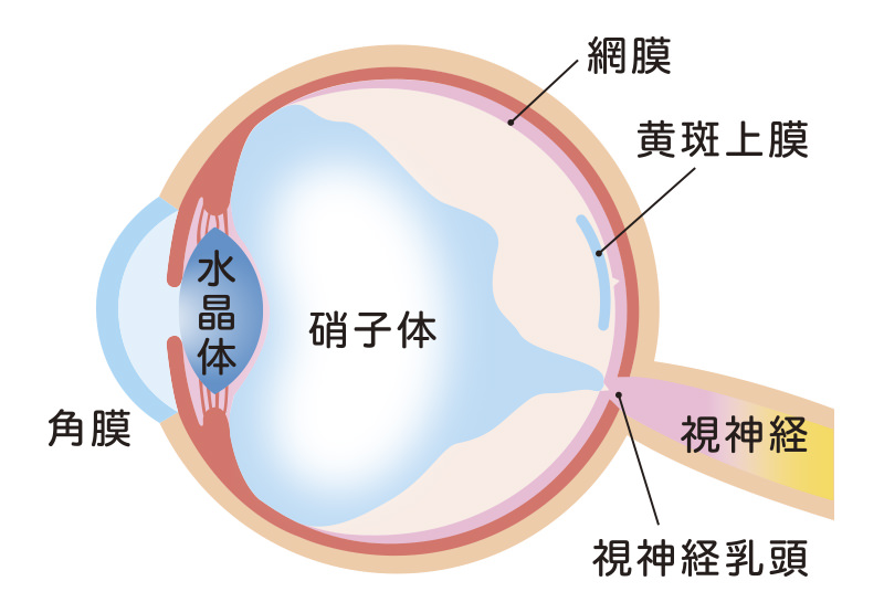 黄斑上膜
